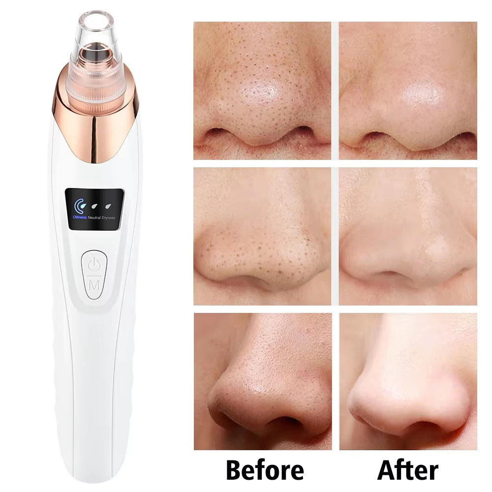 Blackhead Remover Vacuum Pore Adsorber Face Cleaner Electric Pimple Acne Black Head Removal Rechargeable Face Cleaning Tool